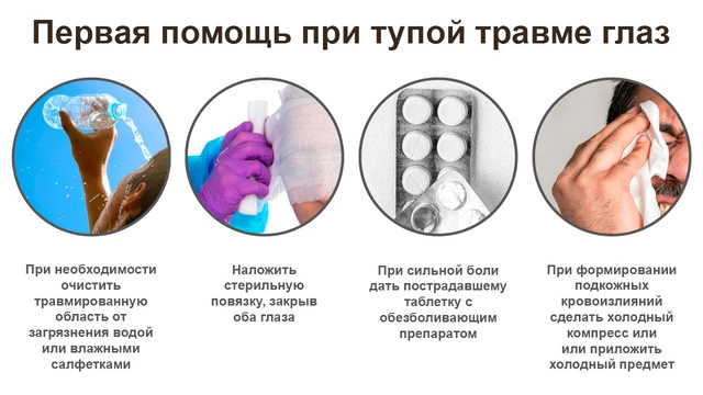 Несколько важных советов с иллюстрациями о первой помощи при тупой травме глаз